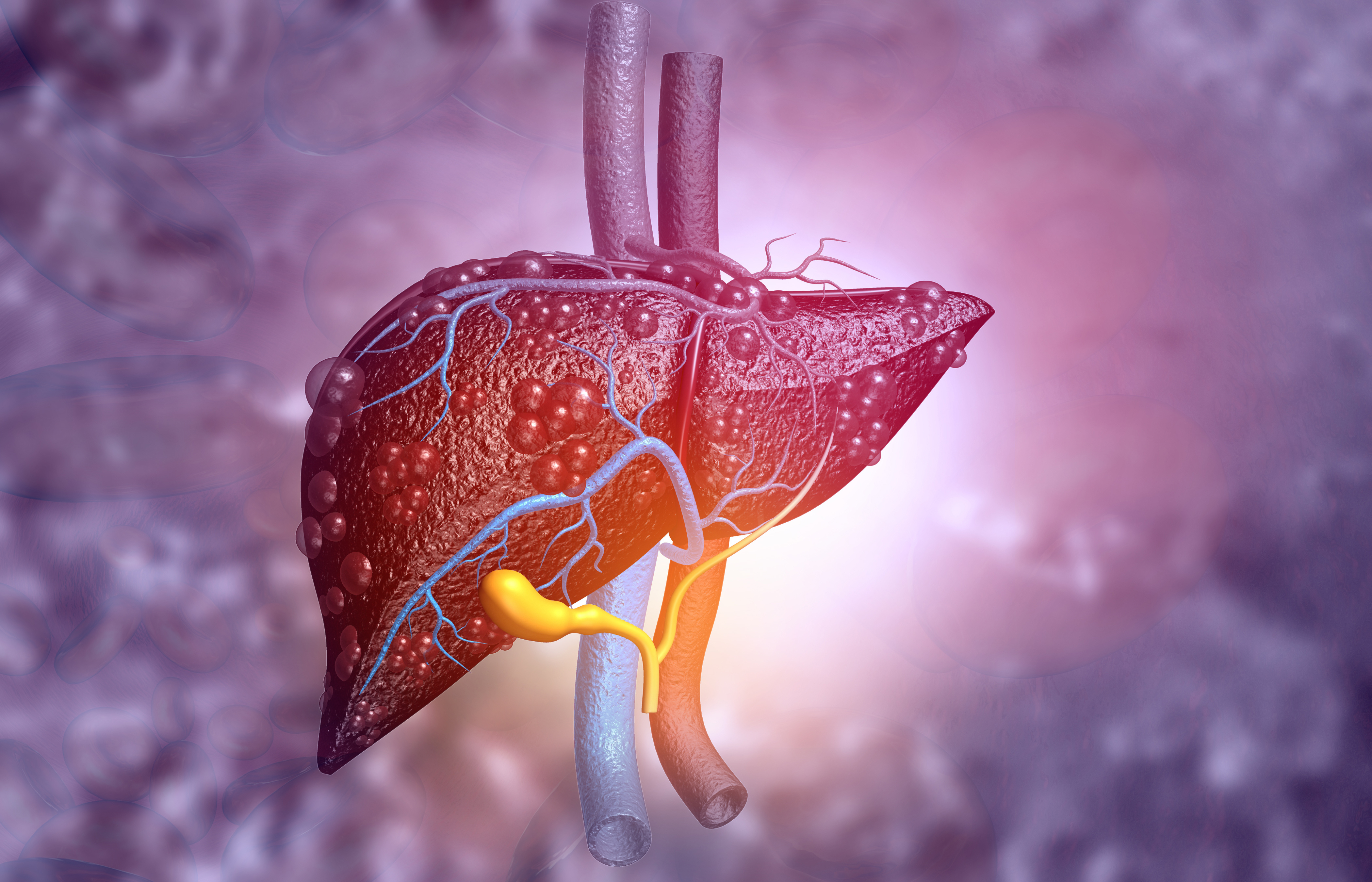 Chronic Liver Disease In Arabic